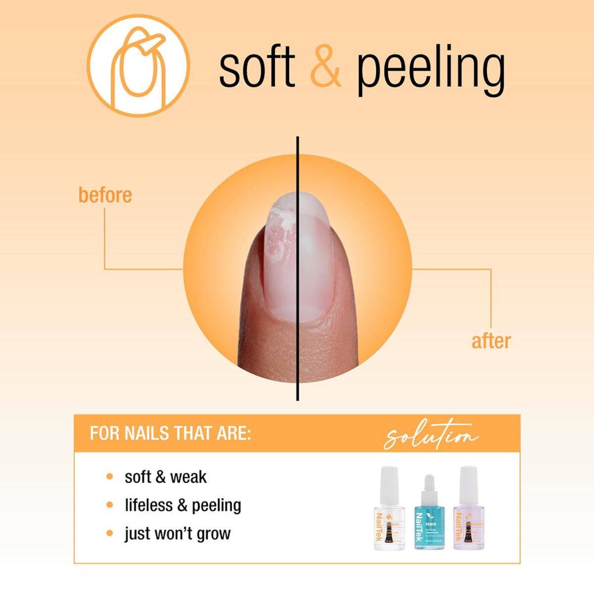 Nail Tek Nail Recovery Kit 3-pc Damaged Nails Kit