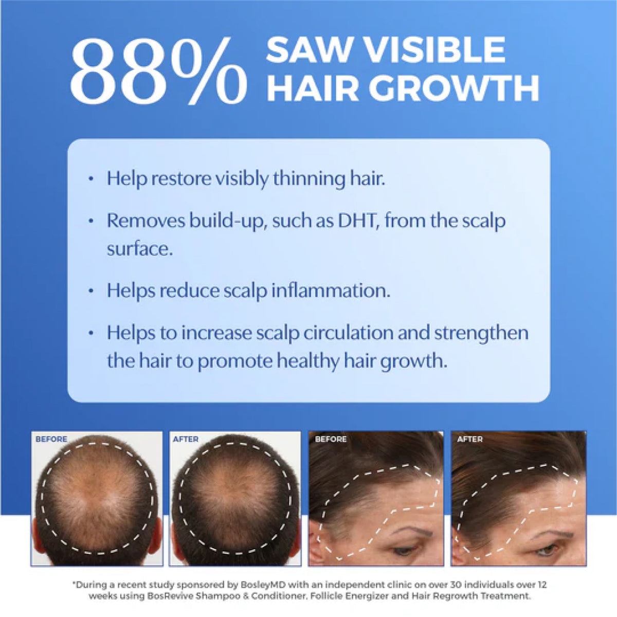 Bosley BosRevive Non Color-Treated Hair Volumizing Conditioner