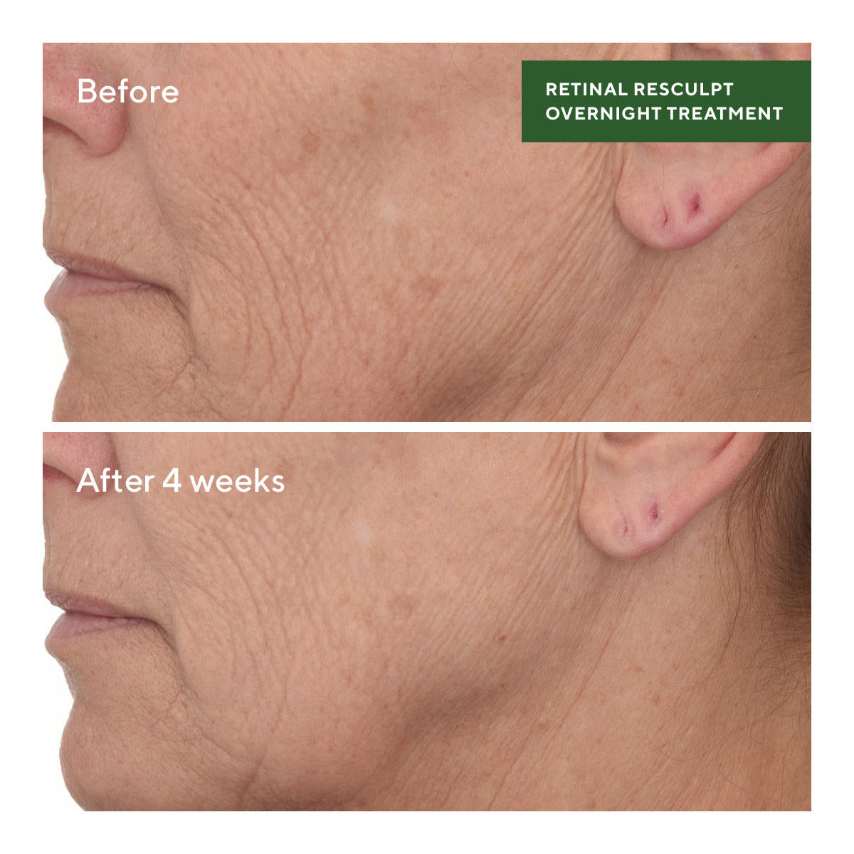 Murad Retinal ReSculpt Overnight Treatment