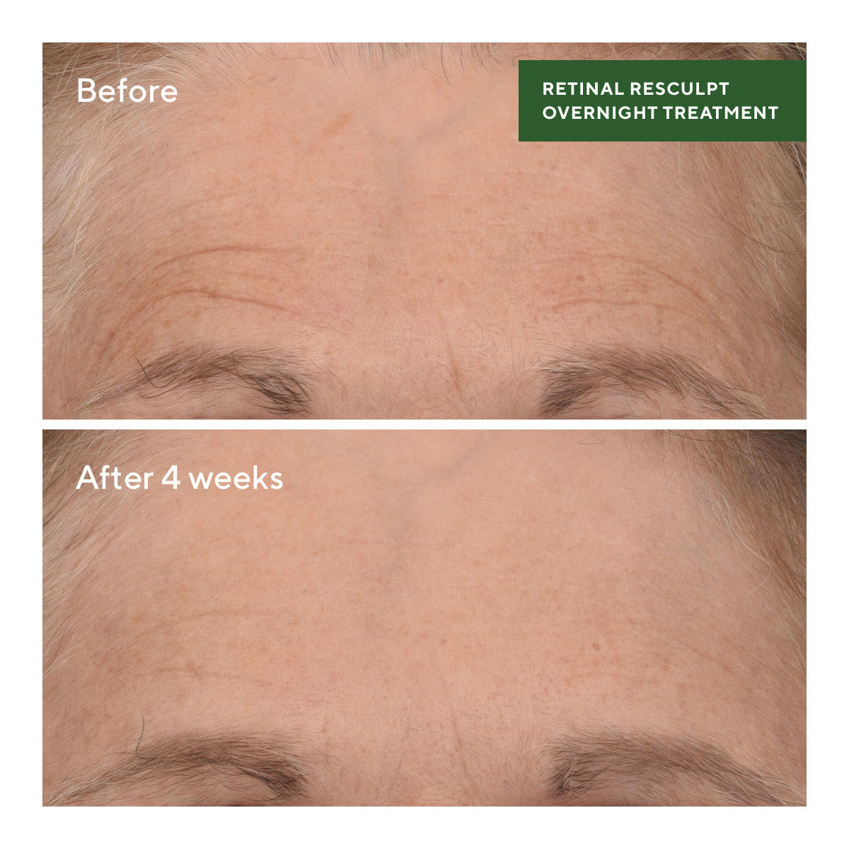 Murad Retinal ReSculpt Overnight Treatment