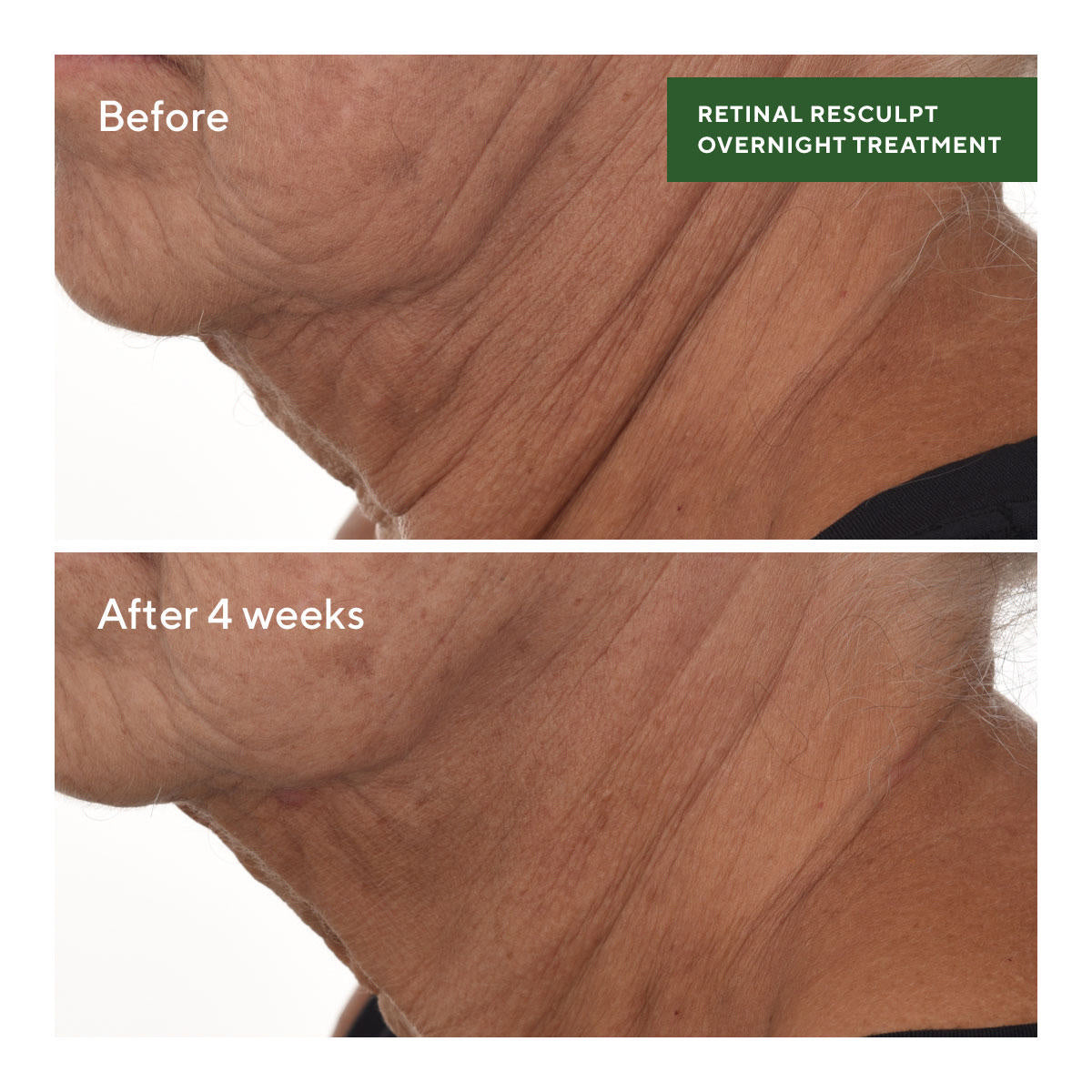 Murad Retinal ReSculpt Overnight Treatment