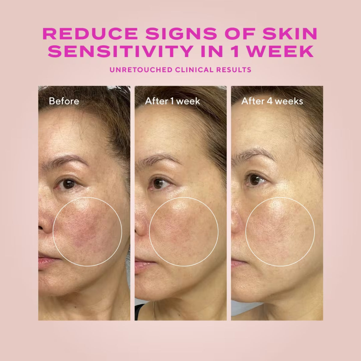 Murad Heartleaf Gentle Resurfacing Serum