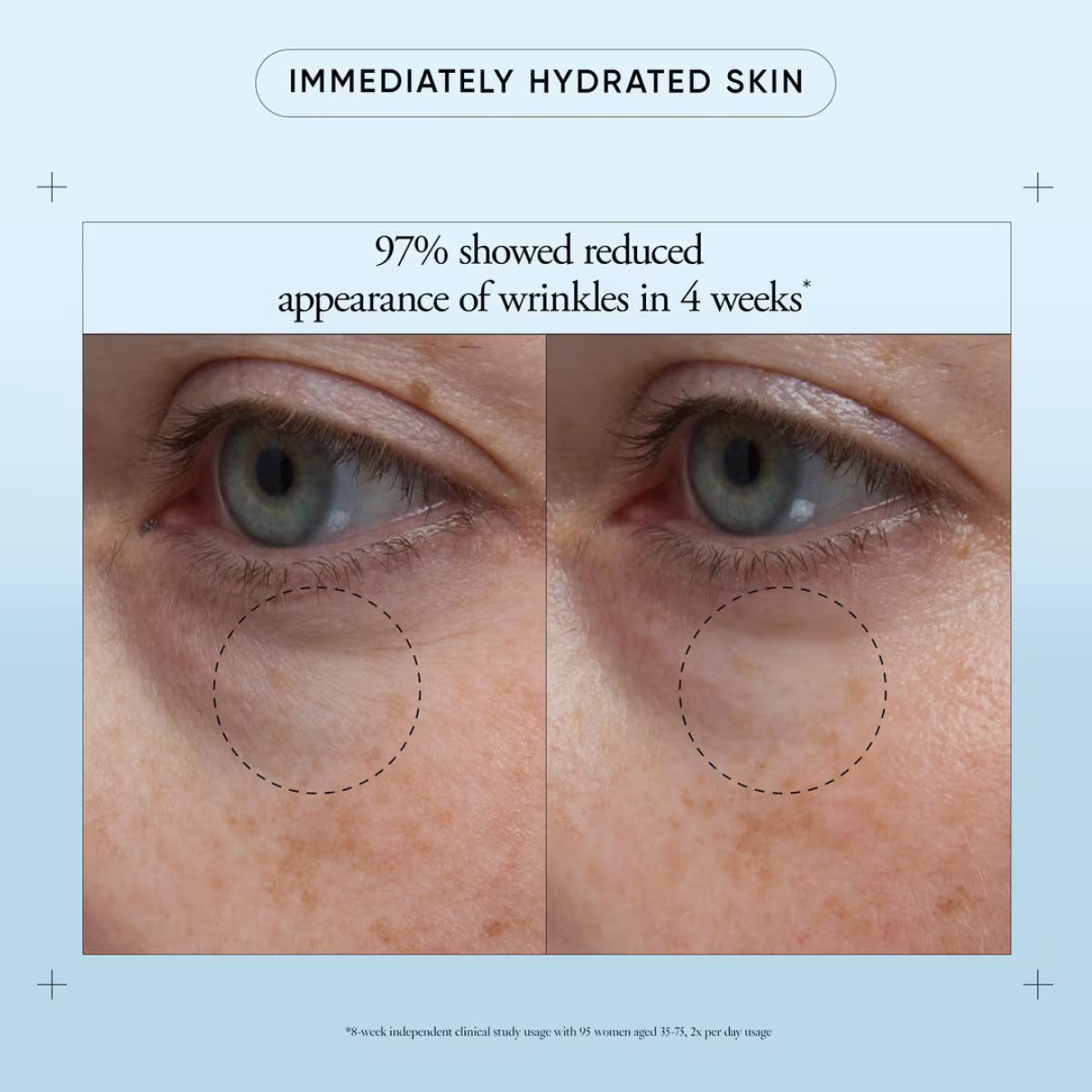 philosophy Hope in A Jar Eye Revival Serum in Cream