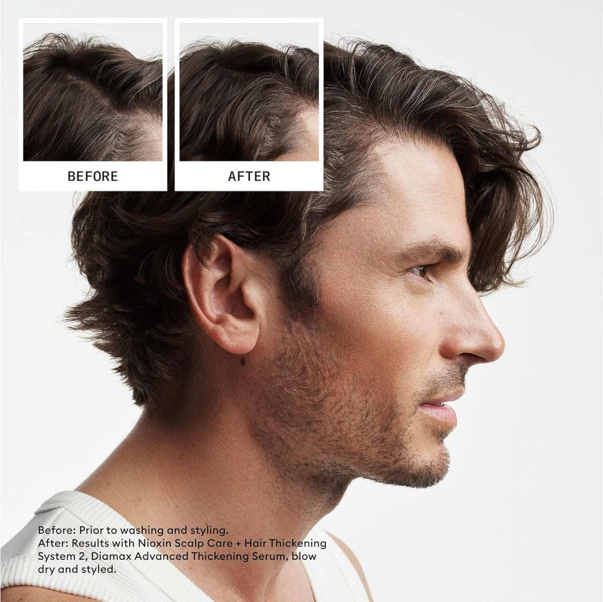 NIOXIN System 2 Scalp Therapy Conditioner