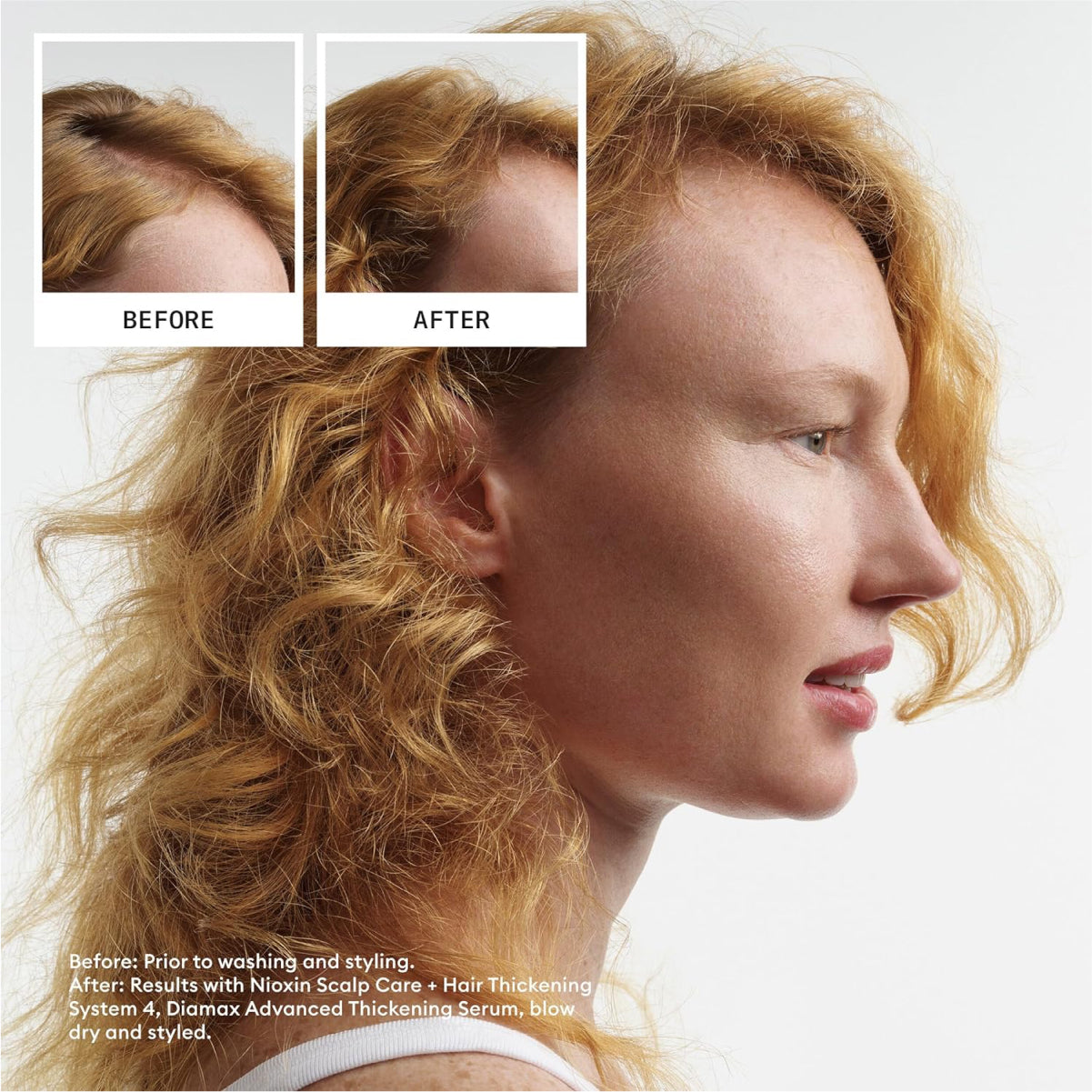 NIOXIN System 4 Scalp Treatment