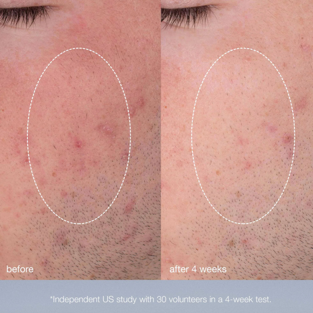 Dermalogica Daily Microfoliant