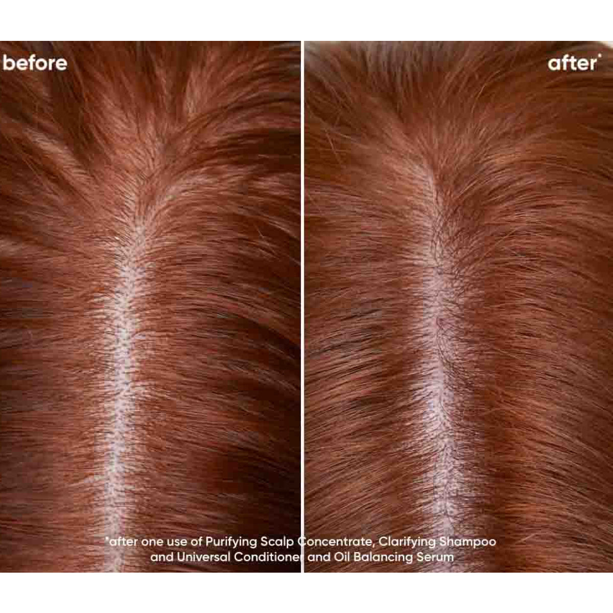 Biolage Scalp Sync Clarifying Shampoo