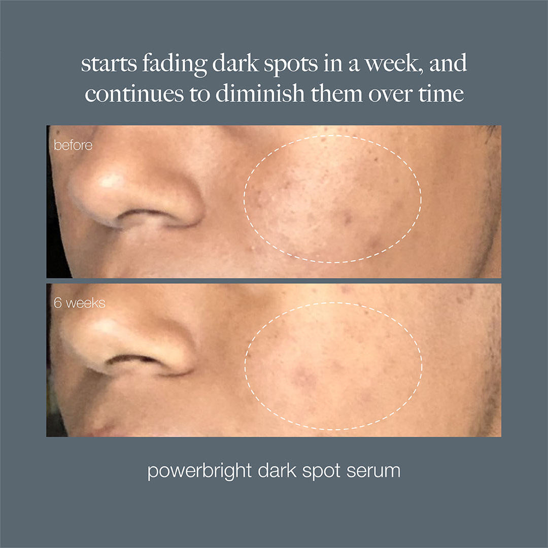 Dermalogica PowerBright Dark Spot Serum
