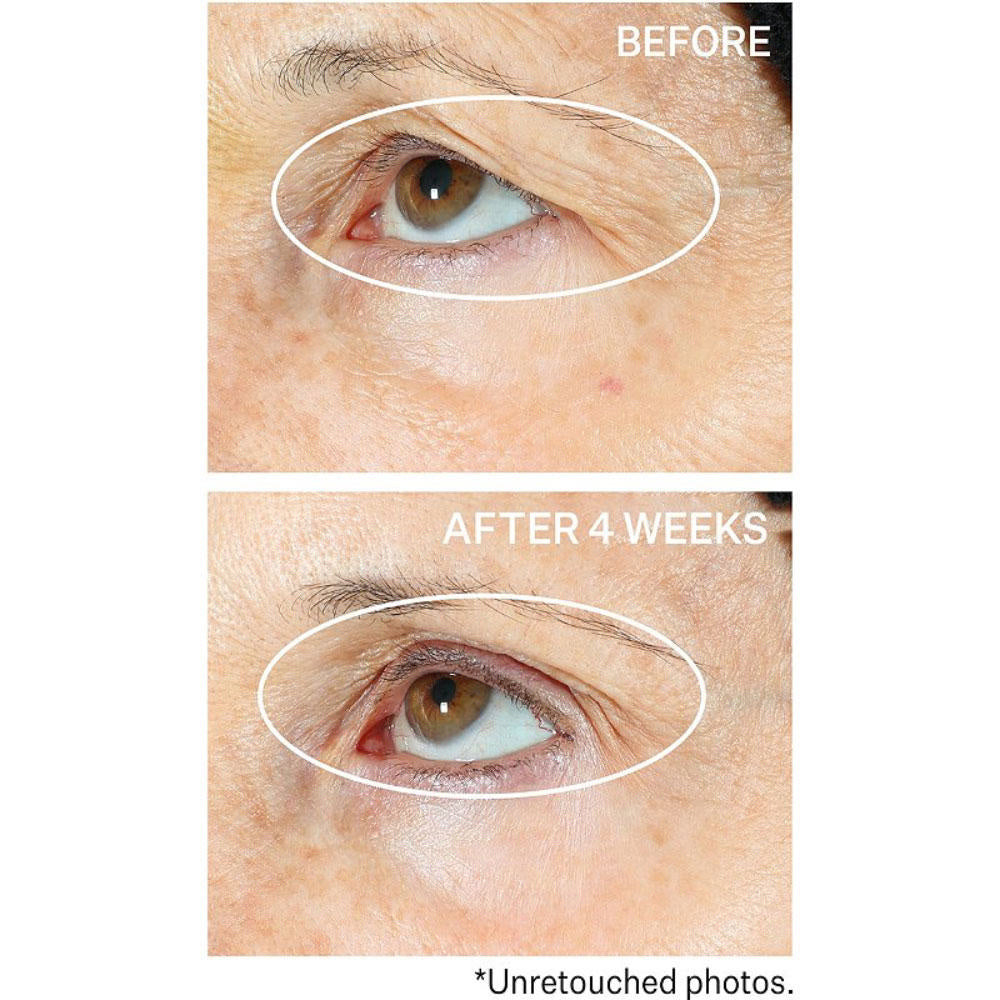 StriVectin Peptight  360  Tightening Eye Serum