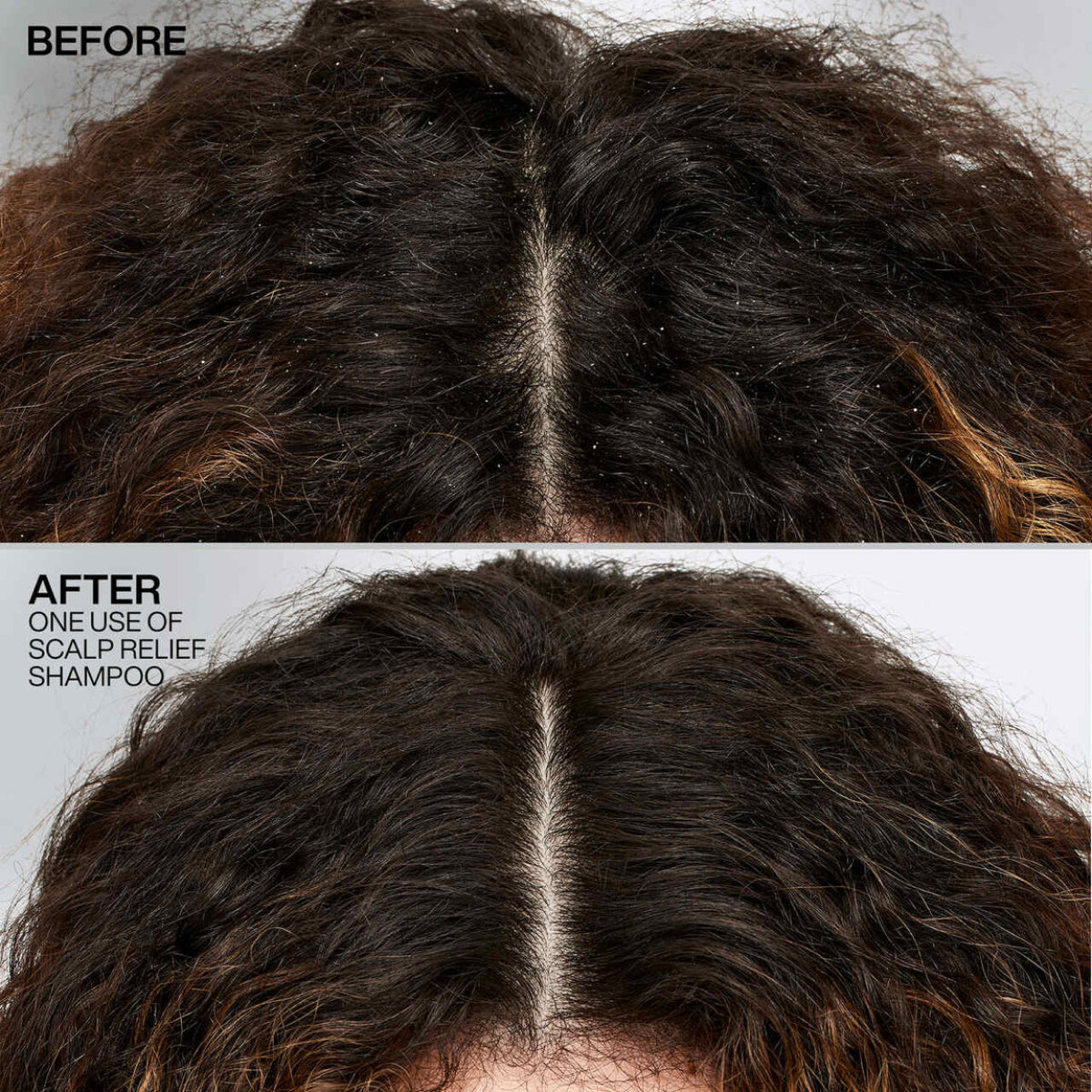 Redken Scalp Relief Dandruff Control Shampoo