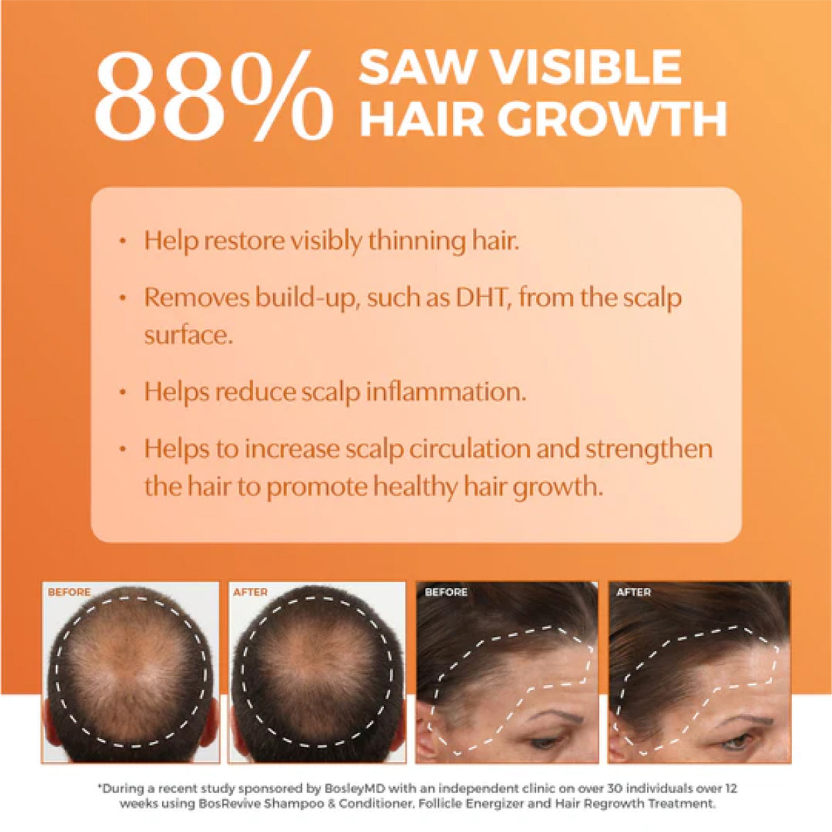 Bosley BosRevive Color Safe Volumizing Conditioner