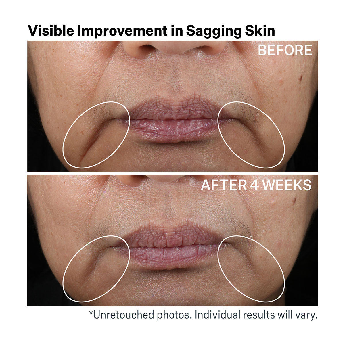 StriVectin Contour Restore  Tightening & Sculpting Face Cream