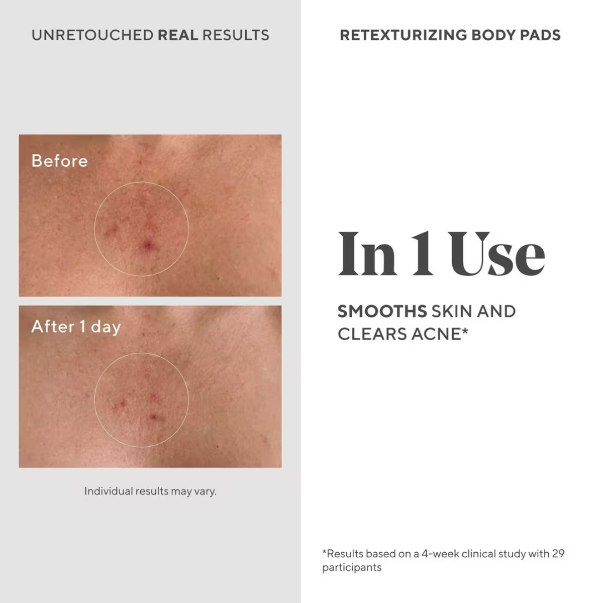 Murad Retexturizing Body Pads