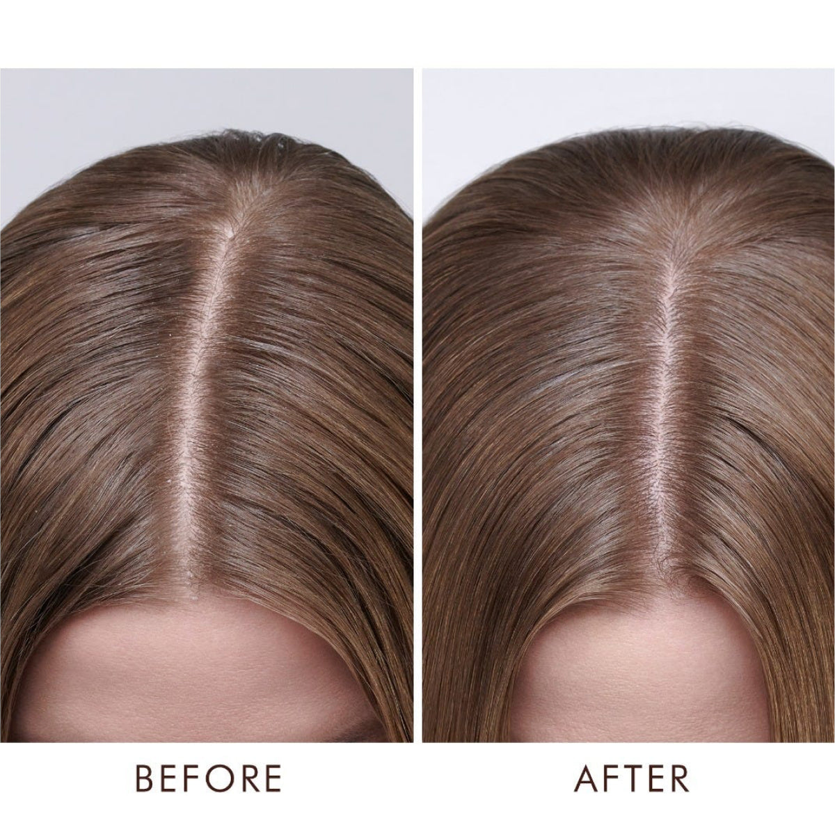 Moroccanoil Scalp Balancing Shampoo