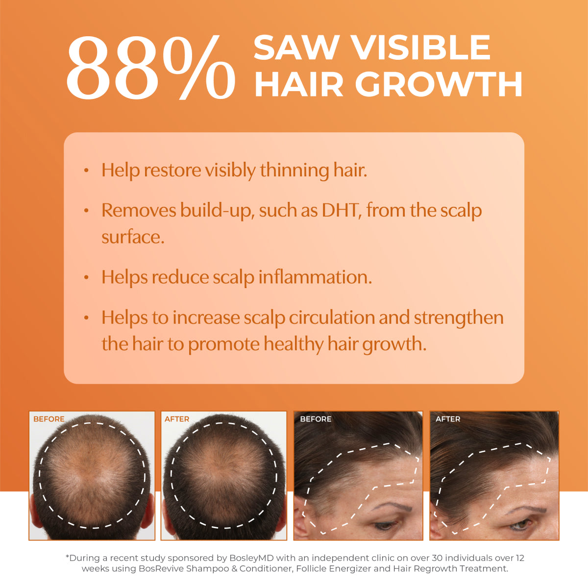 Bosley Revive Color Safe Thickening Treatment