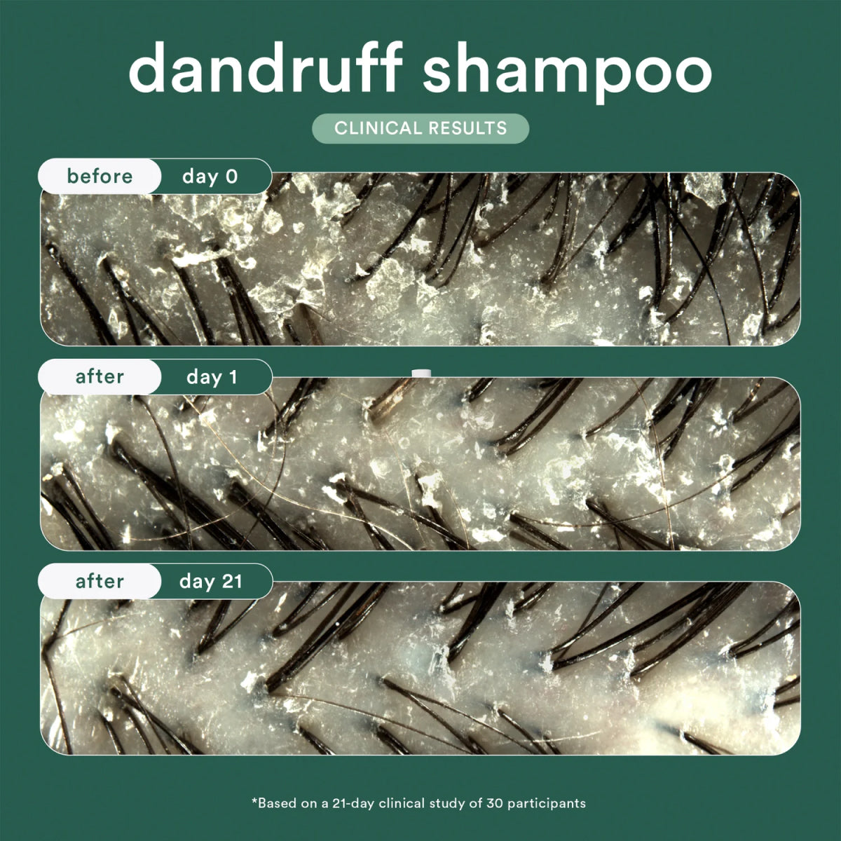 Verb Dandruff Shampoo