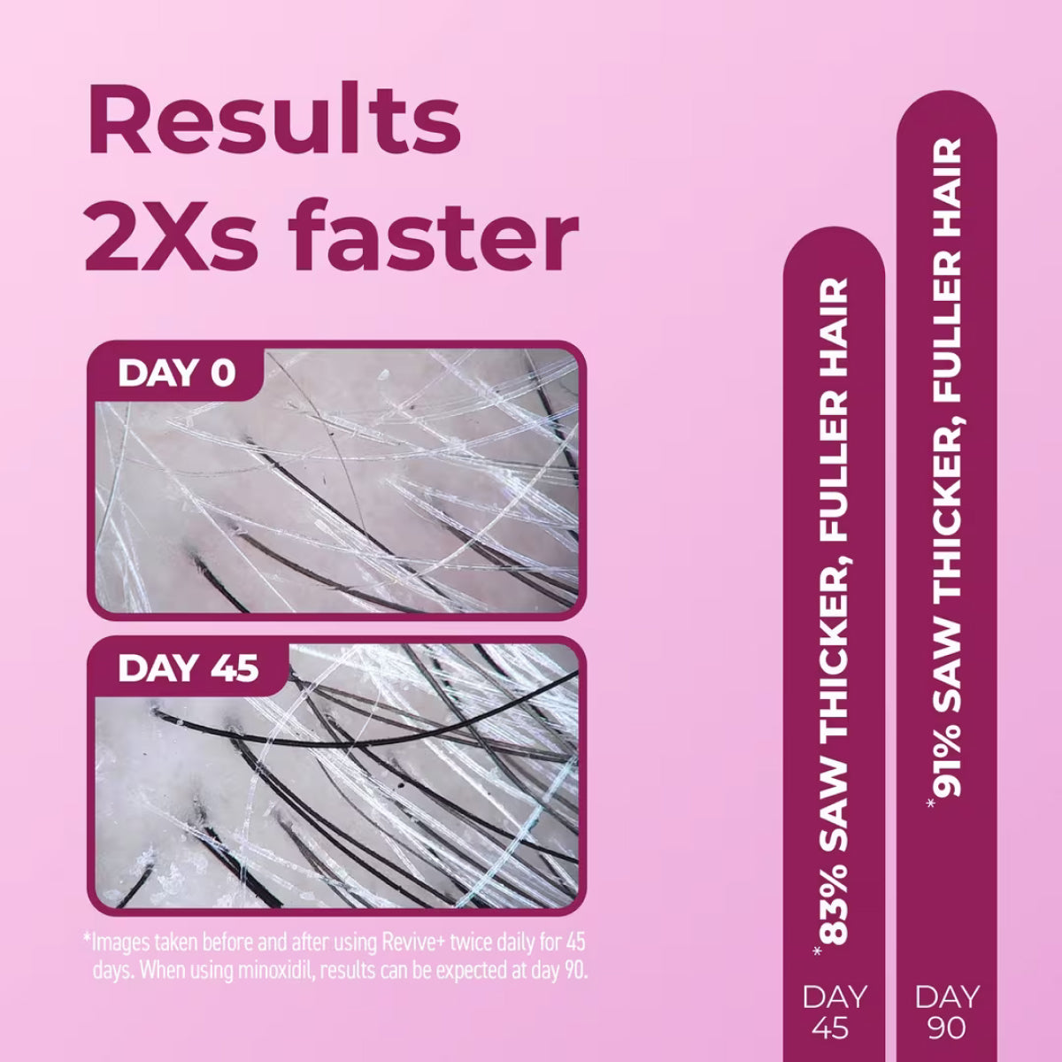 Bosley Women's REVIVE+ Densifying Foam (2 Month Supply)