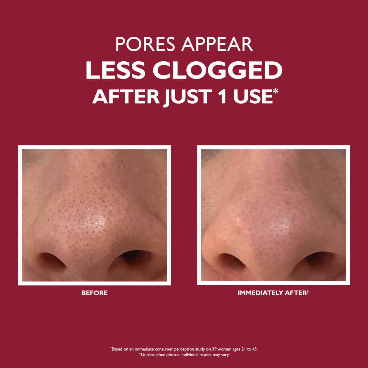 Peter Thomas Roth Even Smoother  Microdermabrasion Exfoliating Pore Treatment