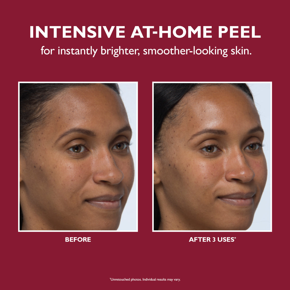 Peter Thomas Roth Even Smoother  Instant Reveal Facial Peel