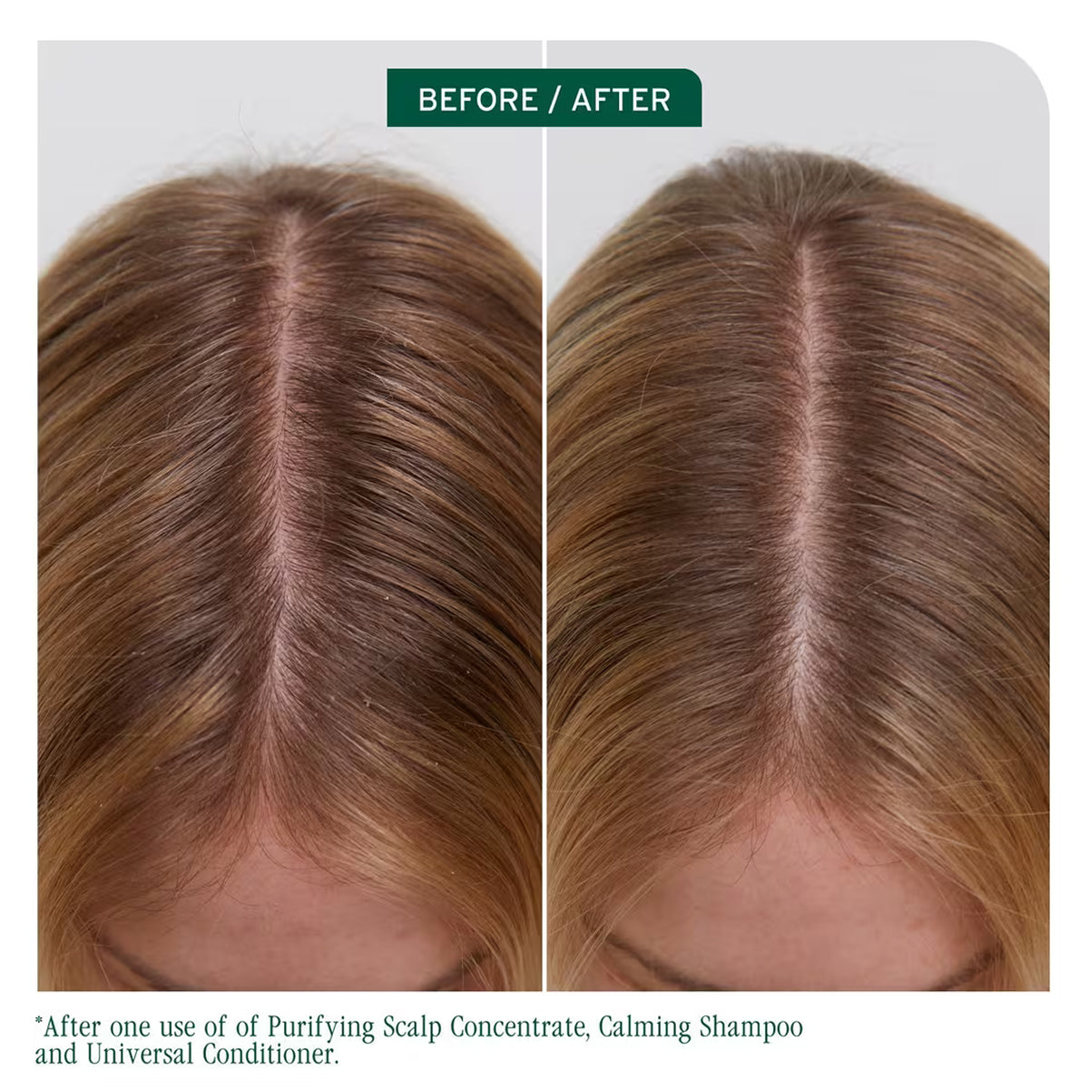 Biolage Scalp Sync Purifying Concentrate