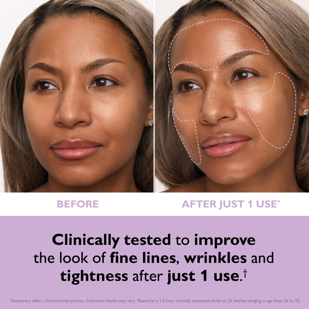 Peter Thomas Roth Instant FIRMx Collagen Tightening Face Patches