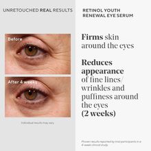 Murad Youth Renewal Retinol Eye Serum