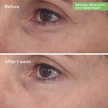 Murad Retinal Resculpt Eye Treatment