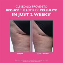 Peter Thomas Roth FIRMx Tight & Toned Cellulite Treatment